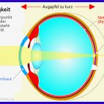 Das Auge Bildentstehung Test 5