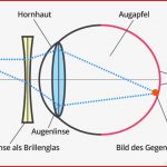 Das Auge Bildentstehung Test 5