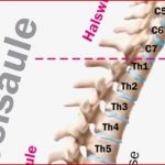 Wirbelsäule Aufbau Und Schwachstellen